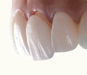 5 Services You Did Not Know Your Dental Center Offers